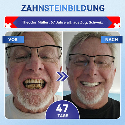 𝐺𝑙𝑖𝑚𝑚𝑒𝑟𝑙𝑦® Tideglusib Zahn & Zahnfleisch Schnelllösliche Repair-Mundstreifen