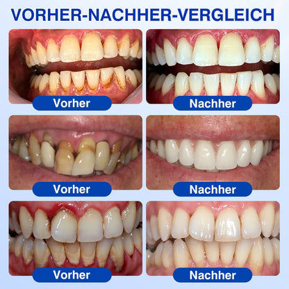 🇨🇭Glimmerly®🦷 GumRevive Parodontales Reparaturgel🌴