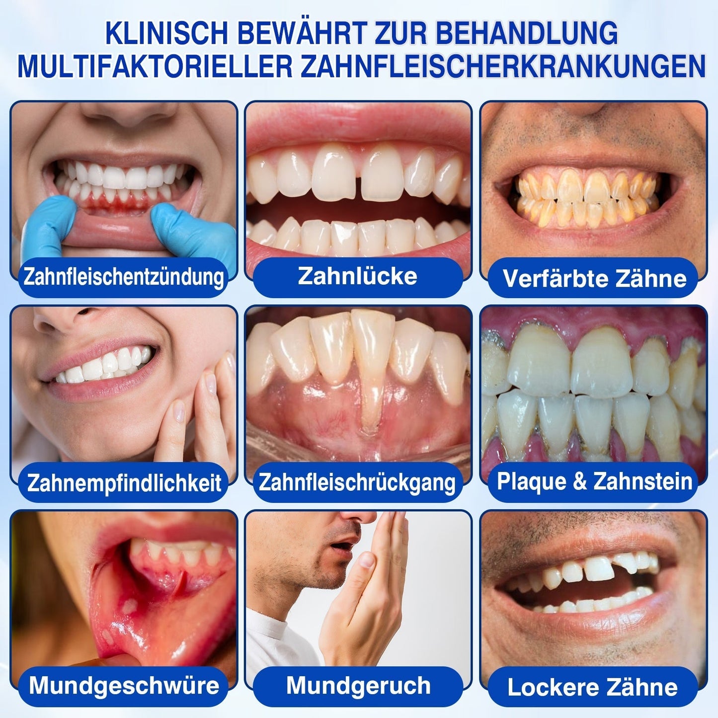 🇨🇭Glimmerly®🦷 GumRevive Parodontales Reparaturgel🌴