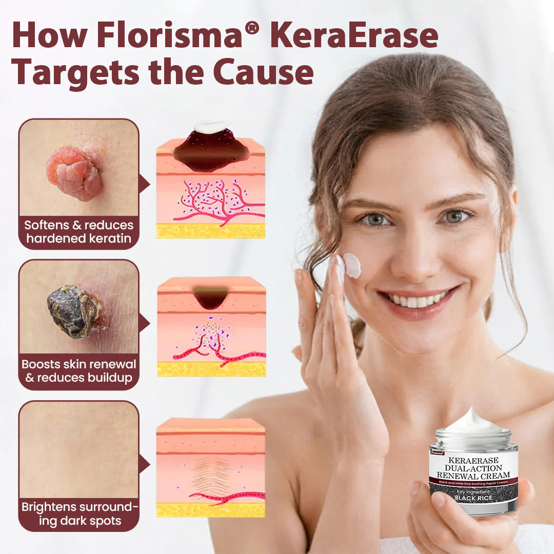 Florisma® KeraErase Dual-Action Renewal Cream ⚡ Discover smooth, clear, and even-looking skin again with a gentle, botanical formula that targets and renews skin irregularities, skin tags, and keratin buildup without irritation👨‍🔬