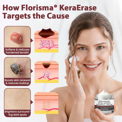Florisma® KeraErase Dual-Action Renewal Cream ⚡ Discover smooth, clear, and even-looking skin again with a gentle, botanical formula that targets and renews skin irregularities, skin tags, and keratin buildup without irritation👨‍🔬