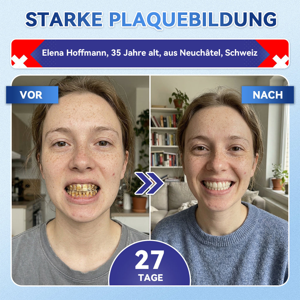 𝐺𝑙𝑖𝑚𝑚𝑒𝑟𝑙𝑦® Tideglusib Zahn & Zahnfleisch Schnelllösliche Repair-Mundstreifen
