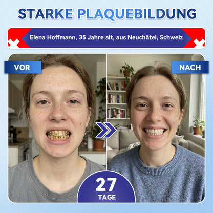 𝐺𝑙𝑖𝑚𝑚𝑒𝑟𝑙𝑦® Tideglusib Zahn & Zahnfleisch Schnelllösliche Repair-Mundstreifen