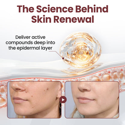 Florisma® KeraErase Dual-Action Renewal Cream ⚡ Discover smooth, clear, and even-looking skin again with a gentle, botanical formula that targets and renews skin irregularities, skin tags, and keratin buildup without irritation👨‍🔬