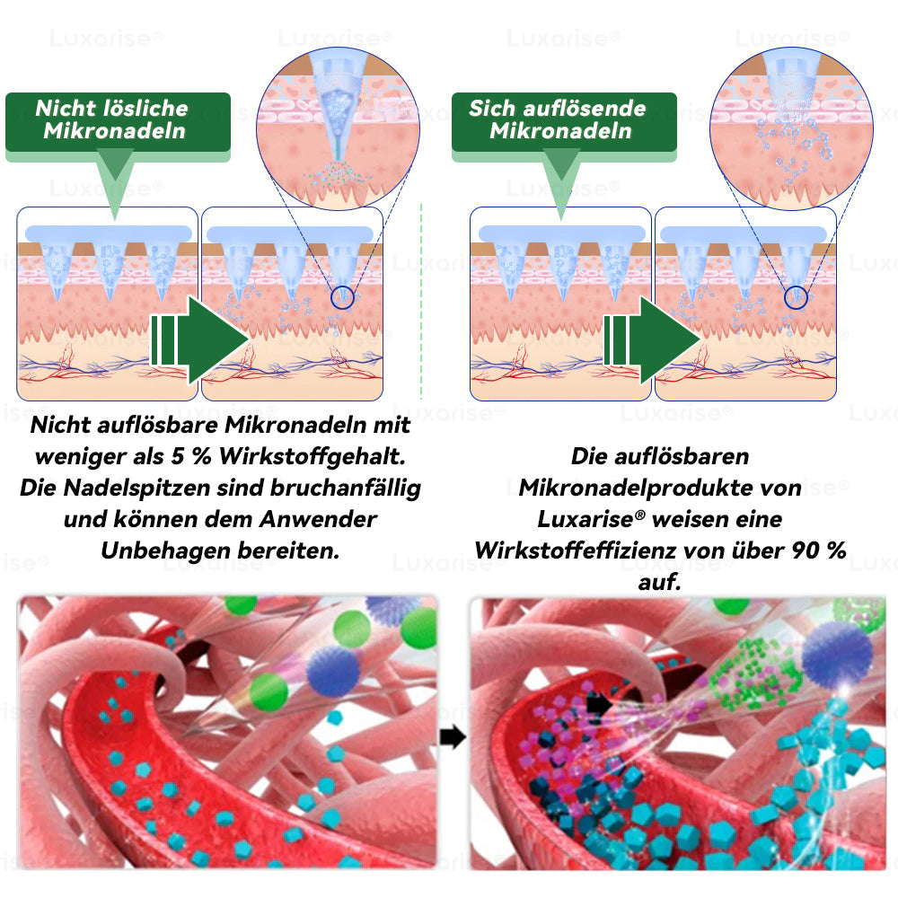 Jeden Tag ein Patch, sichtbare Veränderungen in 7 Tagen  𝑳𝒖𝒙𝒂𝒓𝒊𝒔𝒆® 𝑴𝒐𝒓𝒊𝒏𝒈𝒂 · 𝑩𝒆𝒓𝒃𝒆𝒓𝒊𝒏 10-𝒊𝒏-1 𝑭𝒐𝒓𝒕𝒔𝒄𝒉𝒓𝒊𝒕𝒕𝒍𝒊𝒄𝒉𝒆𝒔 𝑵𝒂𝒏𝒐-𝑴𝒊𝒌𝒓𝒐𝒏𝒂𝒅𝒆𝒍-𝑷𝒇𝒍𝒂𝒔𝒕𝒆𝒓👨‍🔬 (Ü𝒃𝒆𝒓𝒈𝒆𝒘𝒊𝒄𝒉𝒕, 𝑫𝒊𝒂𝒃𝒆𝒕𝒆𝒔, 𝑺𝒄𝒉𝒍𝒂𝒇𝒂𝒑𝒏𝒐𝒆 𝒖𝒏𝒅 𝑮𝒆𝒍𝒆𝒏𝒌𝒑𝒓𝒐𝒃𝒍𝒆𝒎𝒆🥏