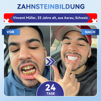 𝐺𝑙𝑖𝑚𝑚𝑒𝑟𝑙𝑦® Tideglusib Zahn & Zahnfleisch Schnelllösliche Repair-Mundstreifen