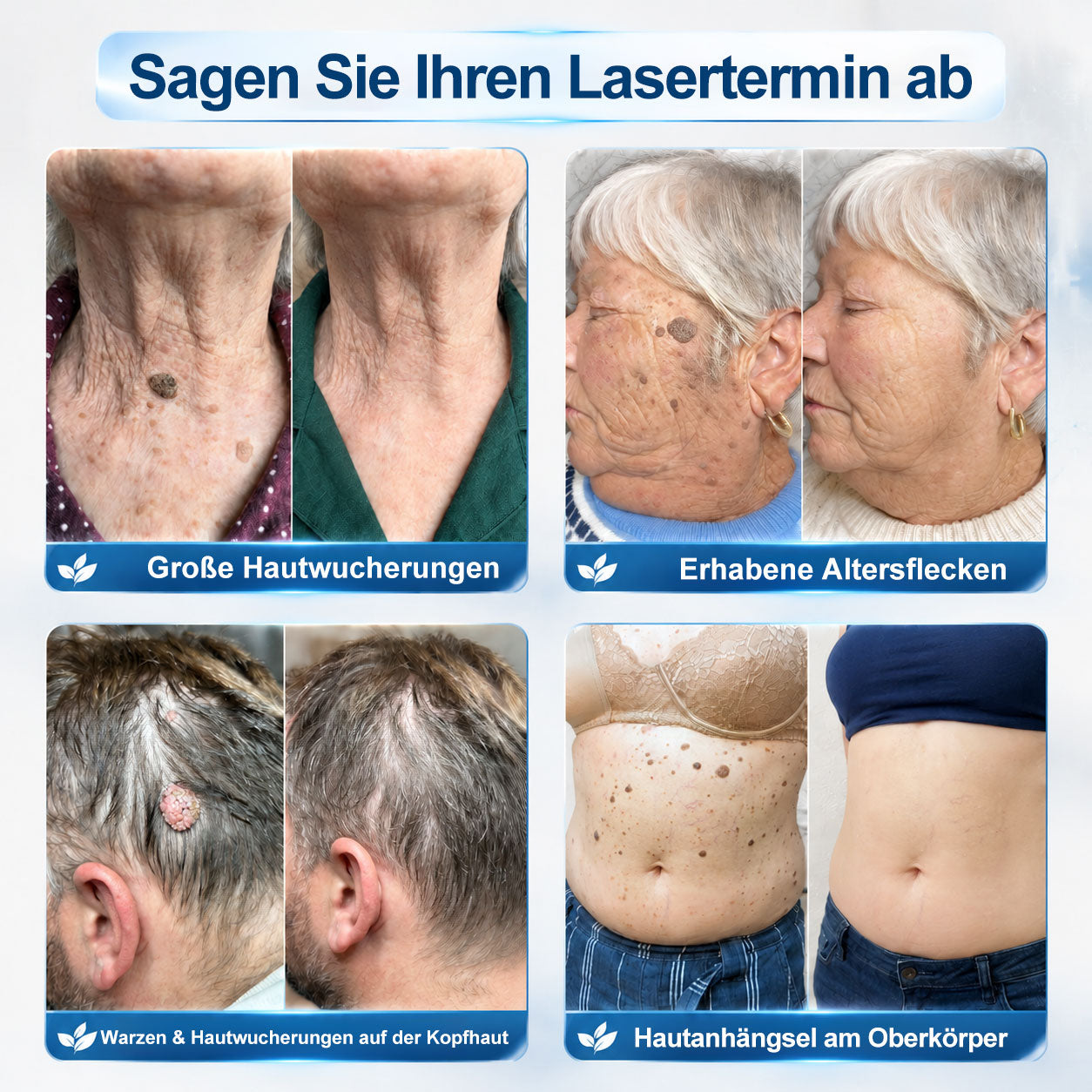 Offizieller Markenstore |👀𝑷𝑖𝒄𝐝𝐨® 7-𝑻𝒂𝒈𝒆 𝑯𝒂𝒖𝒕𝒂𝒏𝒉ä𝒏𝒈𝒔𝒆𝒍- & 𝑭𝒍𝒆𝒄𝒌𝒆𝒏𝒆𝒏𝒕𝒇𝒆𝒓𝒏𝒆𝒓(Schmerzfreier Rollerball – Keine Narbenbildung)🚀