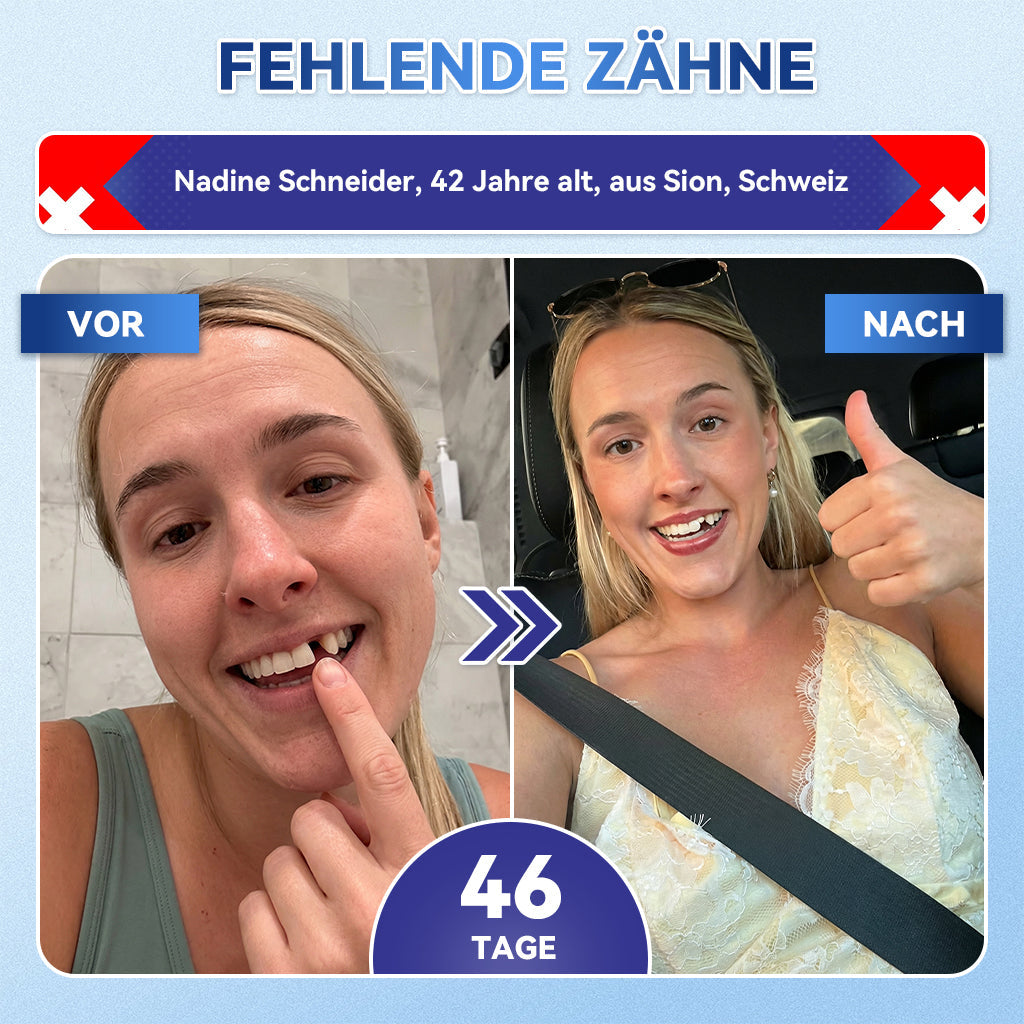 𝐺𝑙𝑖𝑚𝑚𝑒𝑟𝑙𝑦® Tideglusib Zahn & Zahnfleisch Schnelllösliche Repair-Mundstreifen
