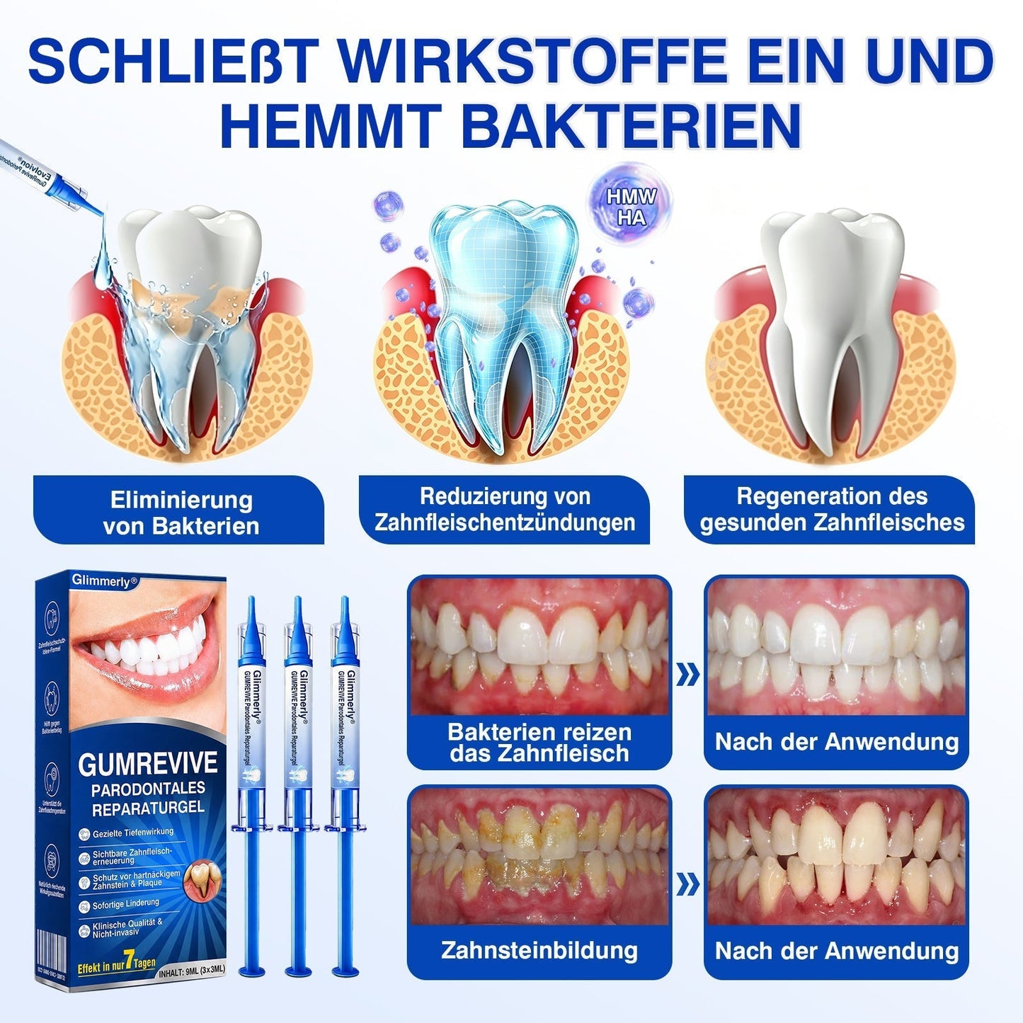 🇨🇭Glimmerly®🦷 GumRevive Parodontales Reparaturgel🌴
