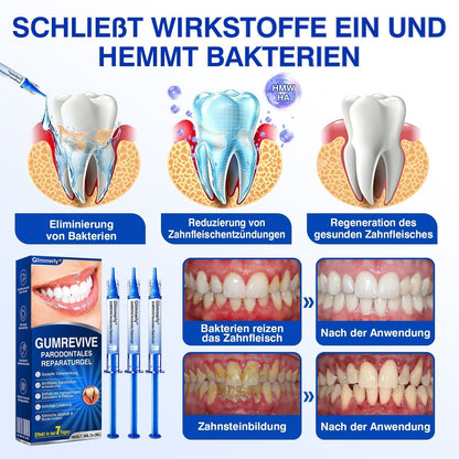 🇨🇭Glimmerly®🦷 GumRevive Parodontales Reparaturgel🌴