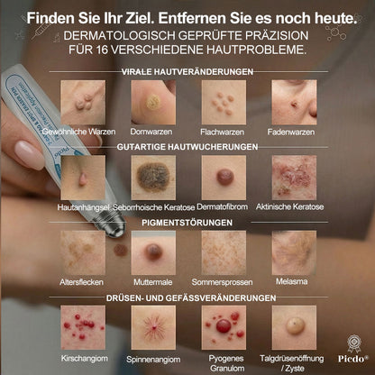 Offizieller Markenstore |👀𝑷𝑖𝒄𝐝𝐨® 7-𝑻𝒂𝒈𝒆 𝑯𝒂𝒖𝒕𝒂𝒏𝒉ä𝒏𝒈𝒔𝒆𝒍- & 𝑭𝒍𝒆𝒄𝒌𝒆𝒏𝒆𝒏𝒕𝒇𝒆𝒓𝒏𝒆𝒓(Schmerzfreier Rollerball – Keine Narbenbildung)🚀