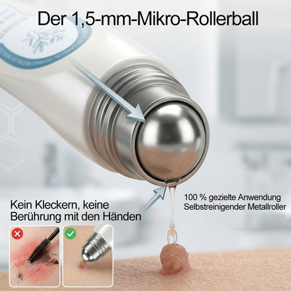 Offizieller Markenstore |👀𝑷𝑖𝒄𝐝𝐨® 7-𝑻𝒂𝒈𝒆 𝑯𝒂𝒖𝒕𝒂𝒏𝒉ä𝒏𝒈𝒔𝒆𝒍- & 𝑭𝒍𝒆𝒄𝒌𝒆𝒏𝒆𝒏𝒕𝒇𝒆𝒓𝒏𝒆𝒓(Schmerzfreier Rollerball – Keine Narbenbildung)🚀